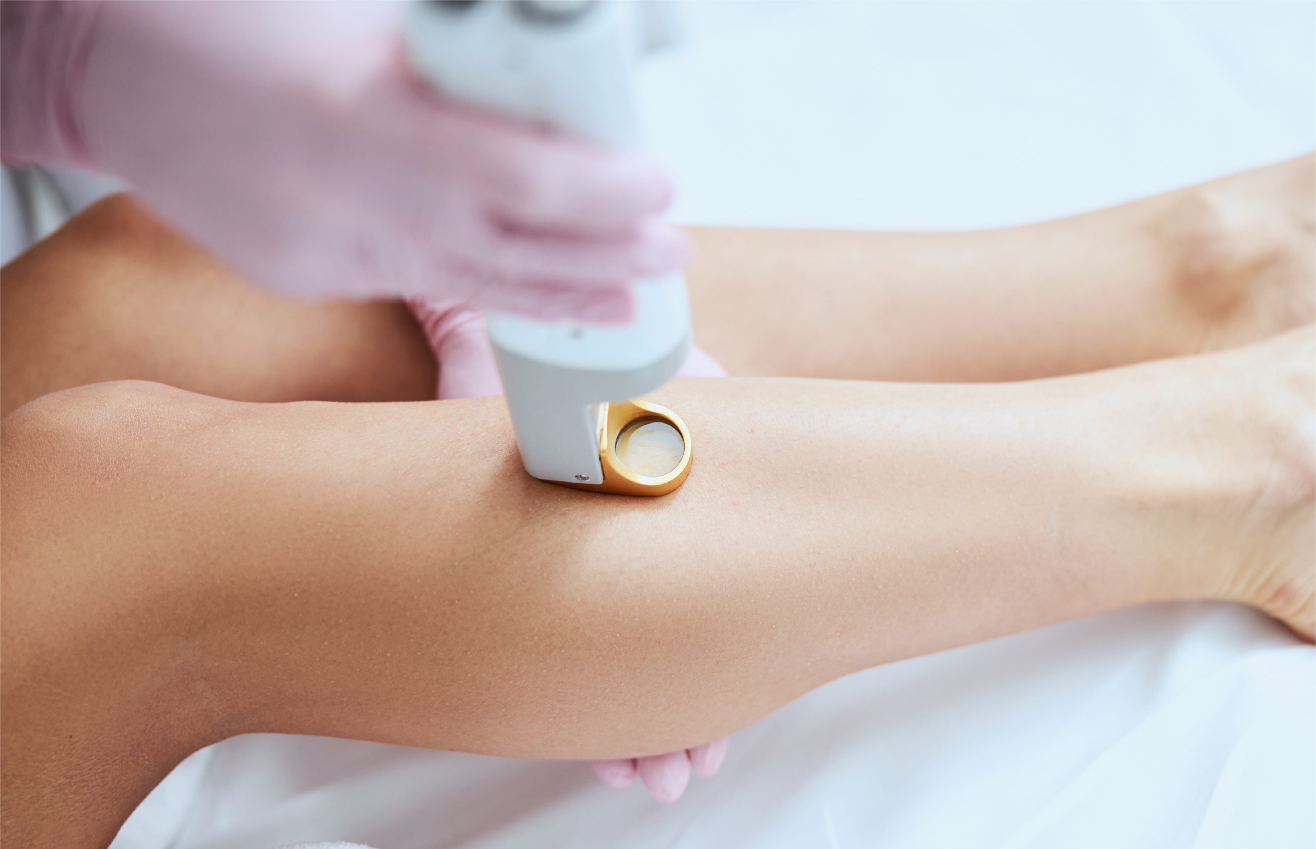 Wax Laser Hair Removal - Smooth Skin Secrets