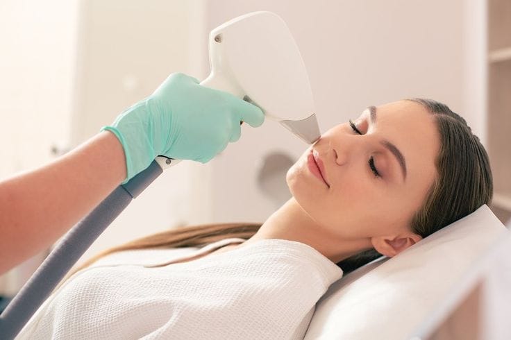 Reclaiming Your Smoothness - Laser Treatment for Chin Hair