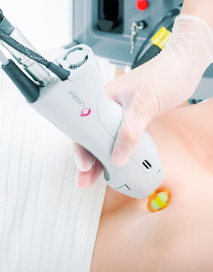 Smooth Safe - Underarm Laser Aftercare