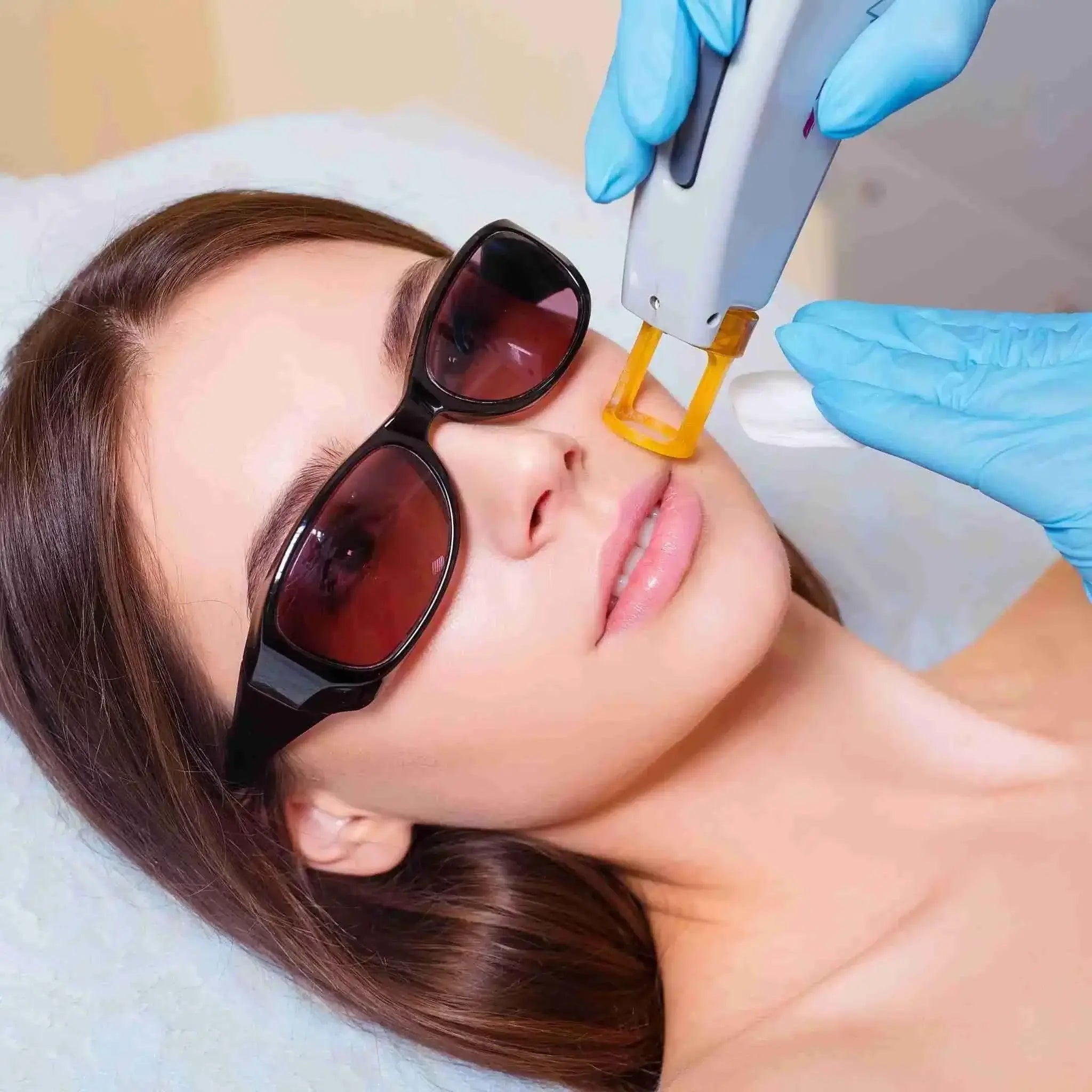 Unlocking Flawless Skin - Laser Treatment for Face Hair Removal Guide
