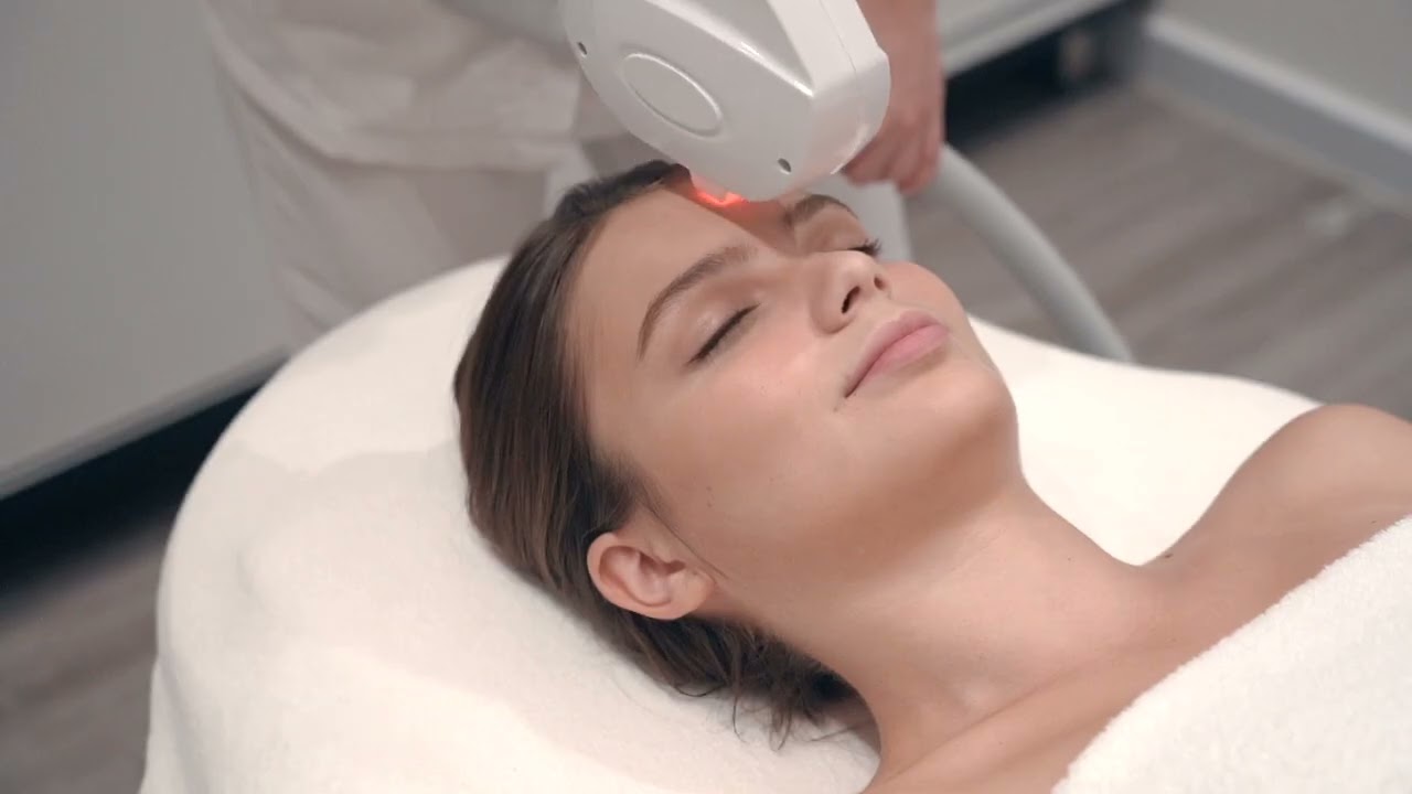 Unlocking Flawless Skin - Laser Treatment for Face Hair Removal Guide