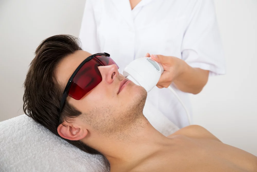 Unlocking Flawless Skin - Laser Treatment for Face Hair Removal Guide